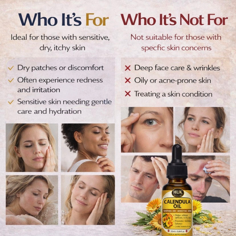 Calendula Oil Benefits – Soothing Oil for Dry, Sensitive & Itchy Skin UK 20ml