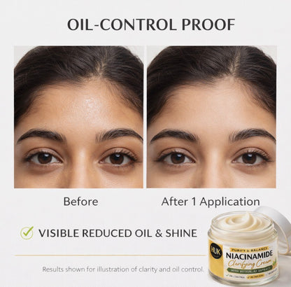 Niacinamide Clarifying Cream 30ml Vernonia & Arnica Acne Control for Oily Skin