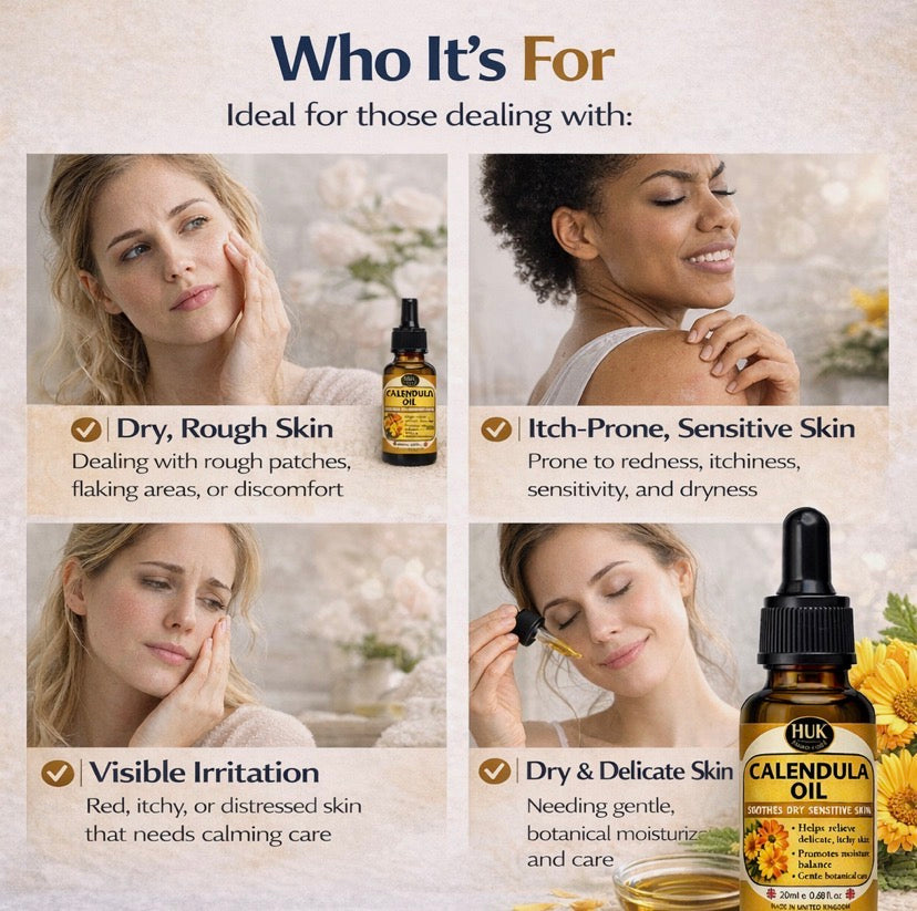 Calendula Oil Benefits – Soothing Oil for Dry, Sensitive & Itchy Skin UK 20ml